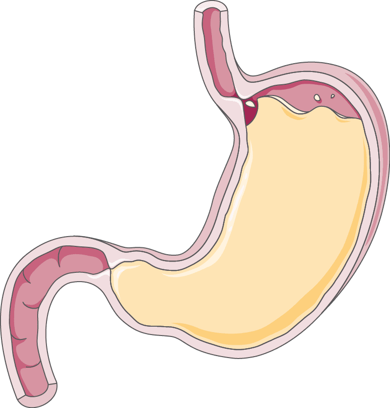 Cross-section illustration of the stomach and upper digestive tract